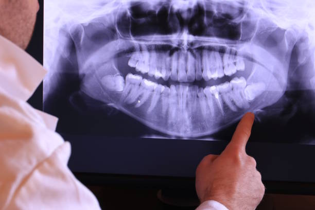Best Emergency Root Canal Treatment in Hahnville, LA