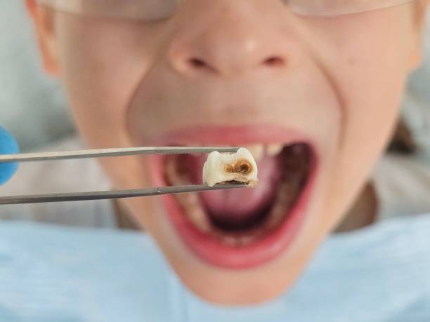 Best Emergency TMJ Treatment in Hahnville, LA