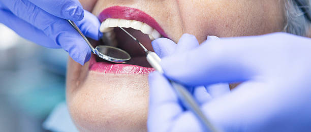 Best Emergency Root Canal Treatment in Hahnville, LA